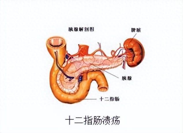 十二指肠图片大全图片