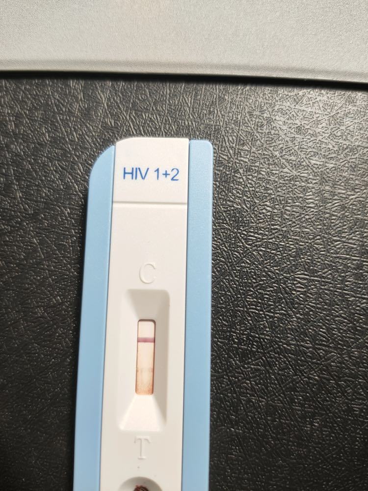 这种情况的出现有可能是包埋线氧化显色.