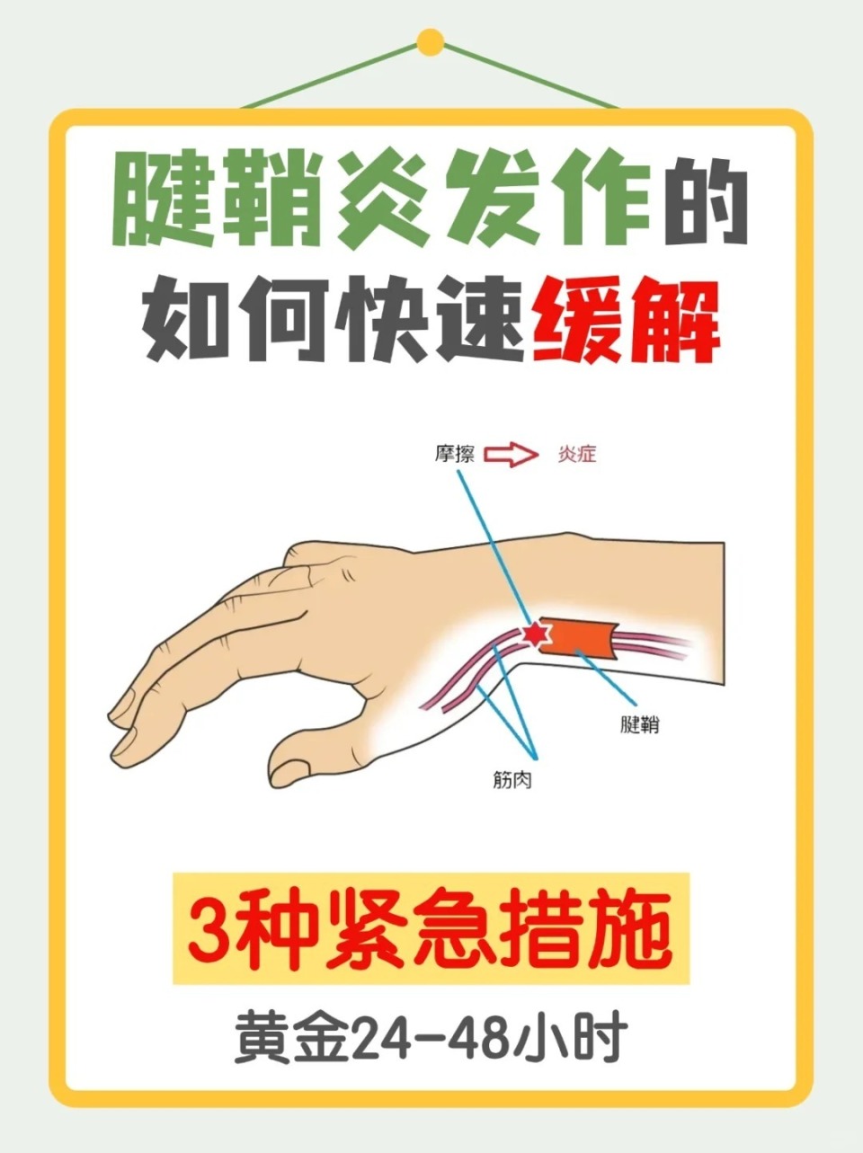 腱鞘炎发作,3种急救措施把握黄金24小时