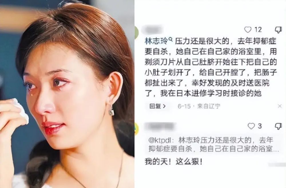 2021林志玲被离婚图片