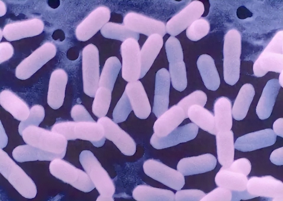 夏季孕妇,新生儿,老人,预防李斯特菌,一旦中招,及时就医!