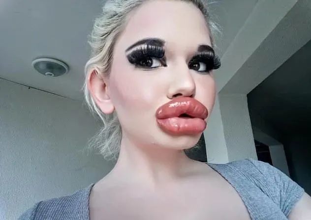 女子痴迷丰唇成为全球嘴唇最厚网红,拍卖自己的厚唇热吻_腾讯新闻