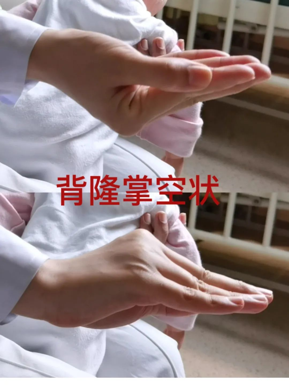 宝宝咳嗽怎么排痰?重医附属儿童医院感染科专家手把手教你_腾讯新闻