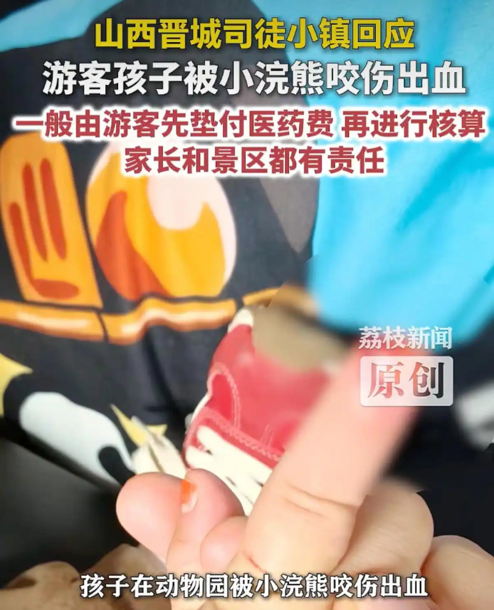 网友称孩子在山西晋城司徒小镇被小浣熊抓咬伤出血，要求出园却几经交涉，景区回应_腾讯新闻