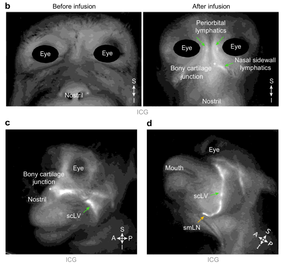 引流器排泄怎么用知名期刊Nature发表：按摩这些部位，帮助大脑排泄代谢废物和毒素，逆转大脑衰老_https://www.jmylbn.com_新闻资讯_第6张