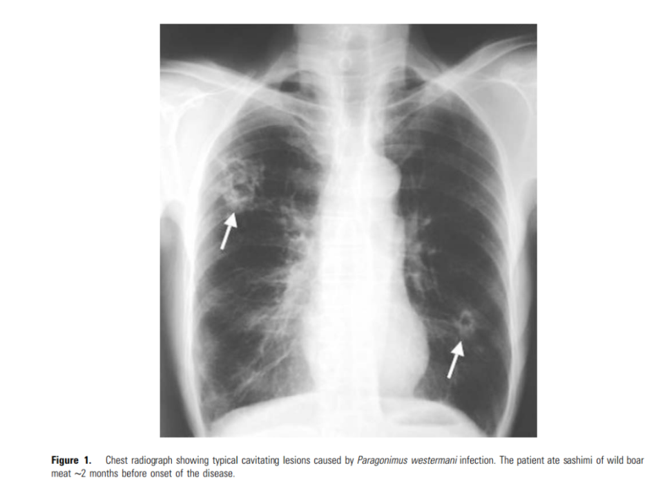 x线 x光 x光片 x线 960_700