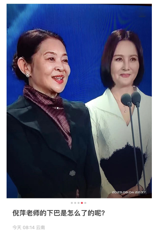 倪萍整容痕迹越来越明显,"倒三角"下巴又尖又长,脸僵硬不自然_腾讯