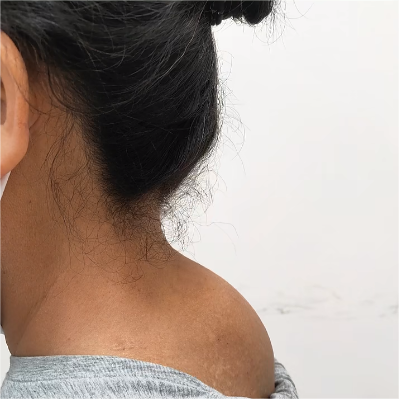 脖子后面有个"富贵包"?5个动作教你逐步消除,重拾优美体态!