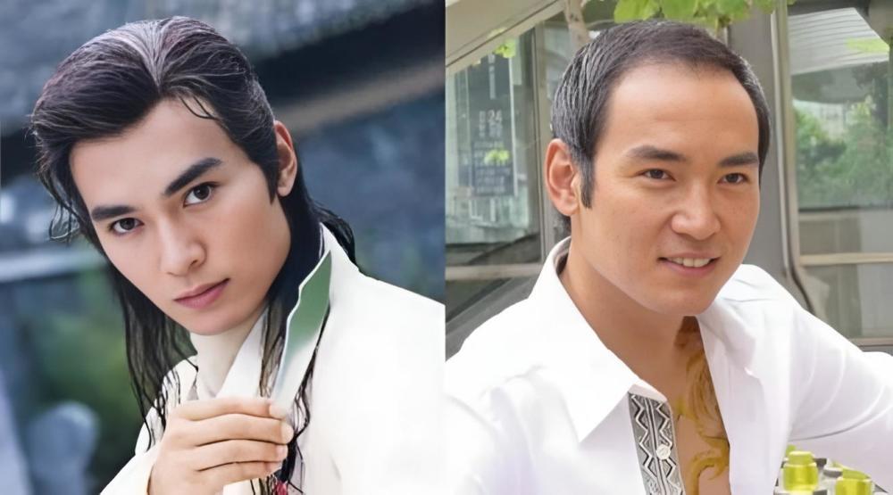 古装男神焦恩俊的秃顶,也是从中年后开始.