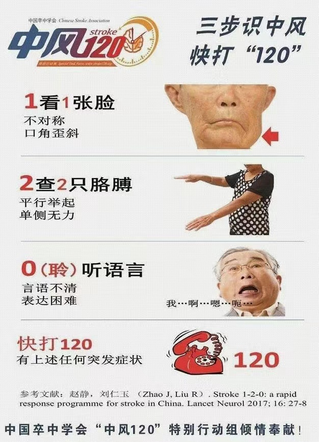 脑梗死症状图片图片