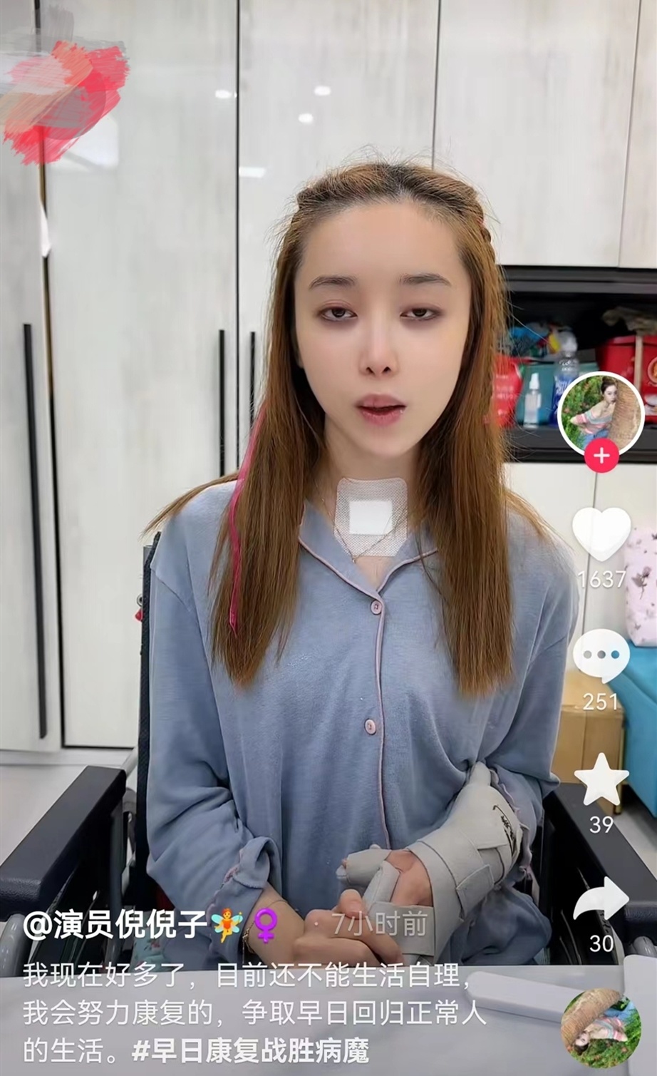 女演员肖妍倪植物人苏醒后发声,否认整形过度导致昏迷