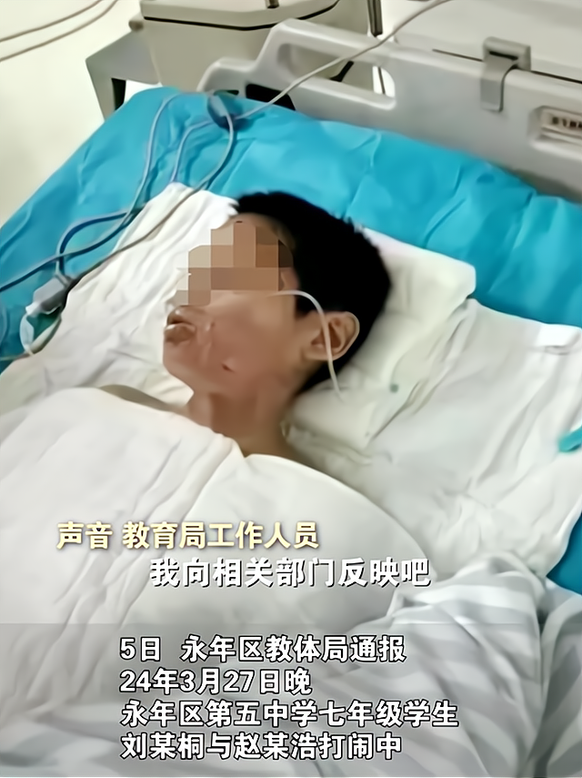 邯郸男孩被灌开水烫伤官方通报和稀泥网友这不是打闹是霸凌