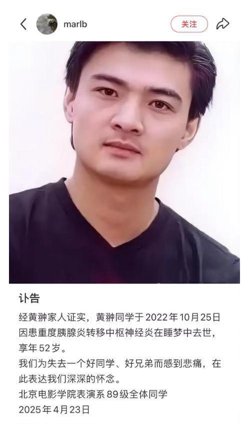 演员黄翀去世真相被曝光！死因是中度胰腺炎，最后露脸照晒出令人心疼_腾讯新闻