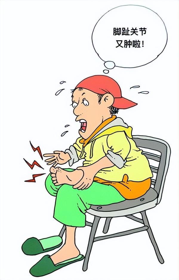 痛风急性发作的年轻患者增加!这些高危致病因素要注意_腾讯新闻