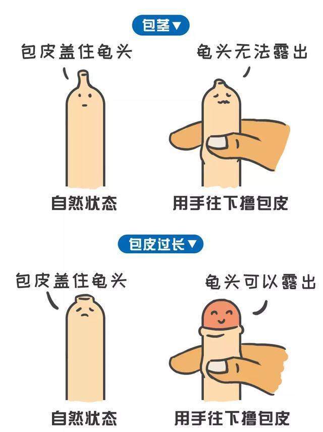 男生为什么要割包皮图片为什么在线