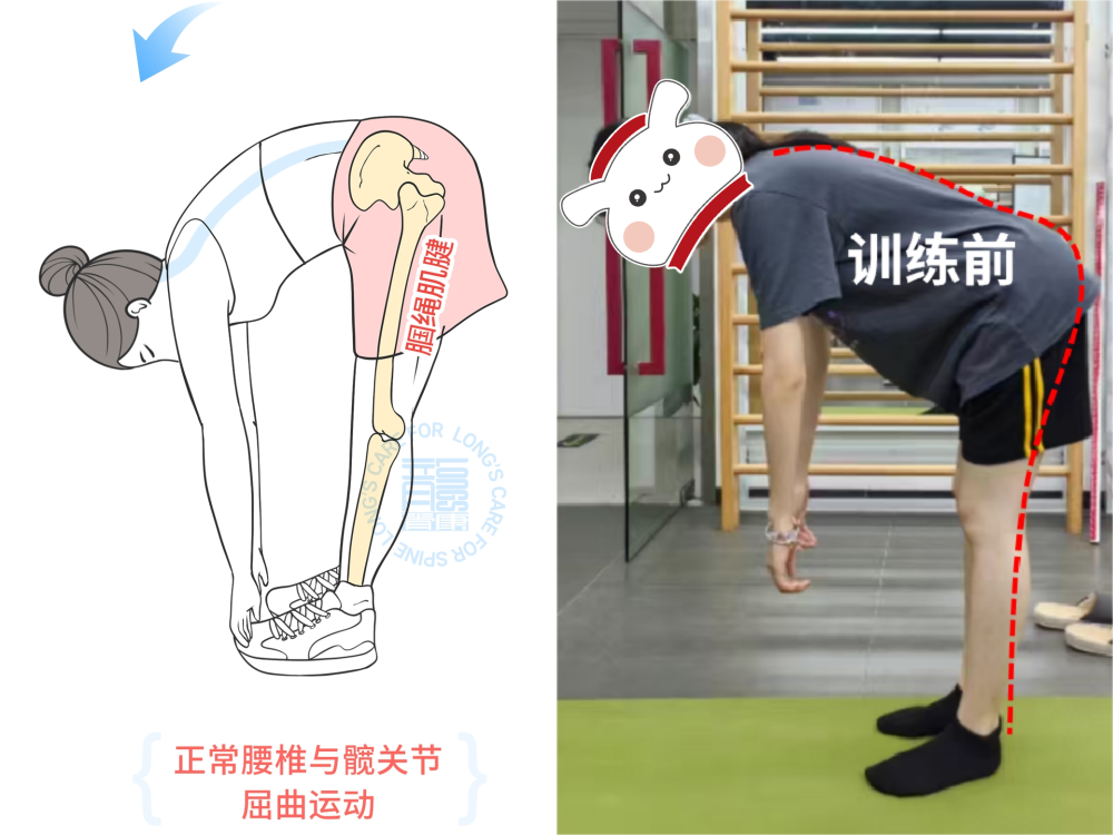 为什么每次弯腰都疼痛难忍,弯不下去?