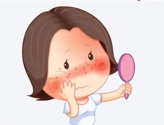 油头、油脸、油脖子？可能脂溢性皮炎作怪，科学护理不踩坑_腾讯新闻