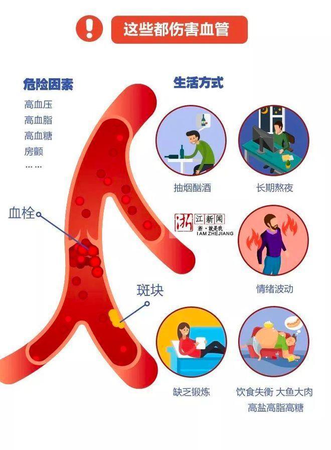 血管堵塞的十大征兆图片