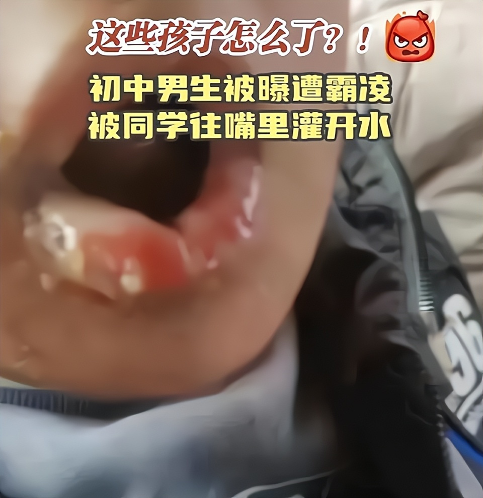 邯郸男孩被灌开水烫伤官方通报和稀泥网友这不是打闹是霸凌
