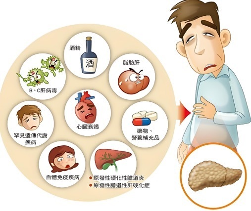 熬夜肝脏位置疼痛图片