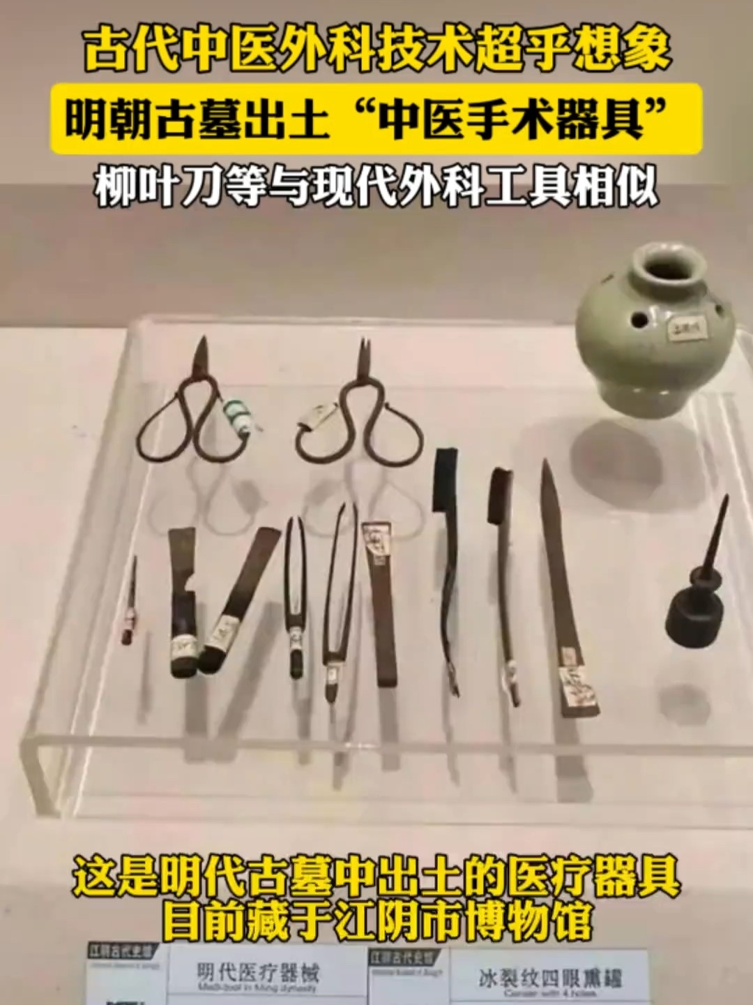 古墓惊现明代手术刀！全套外科器械出土，改写对中医的印象_腾讯新闻