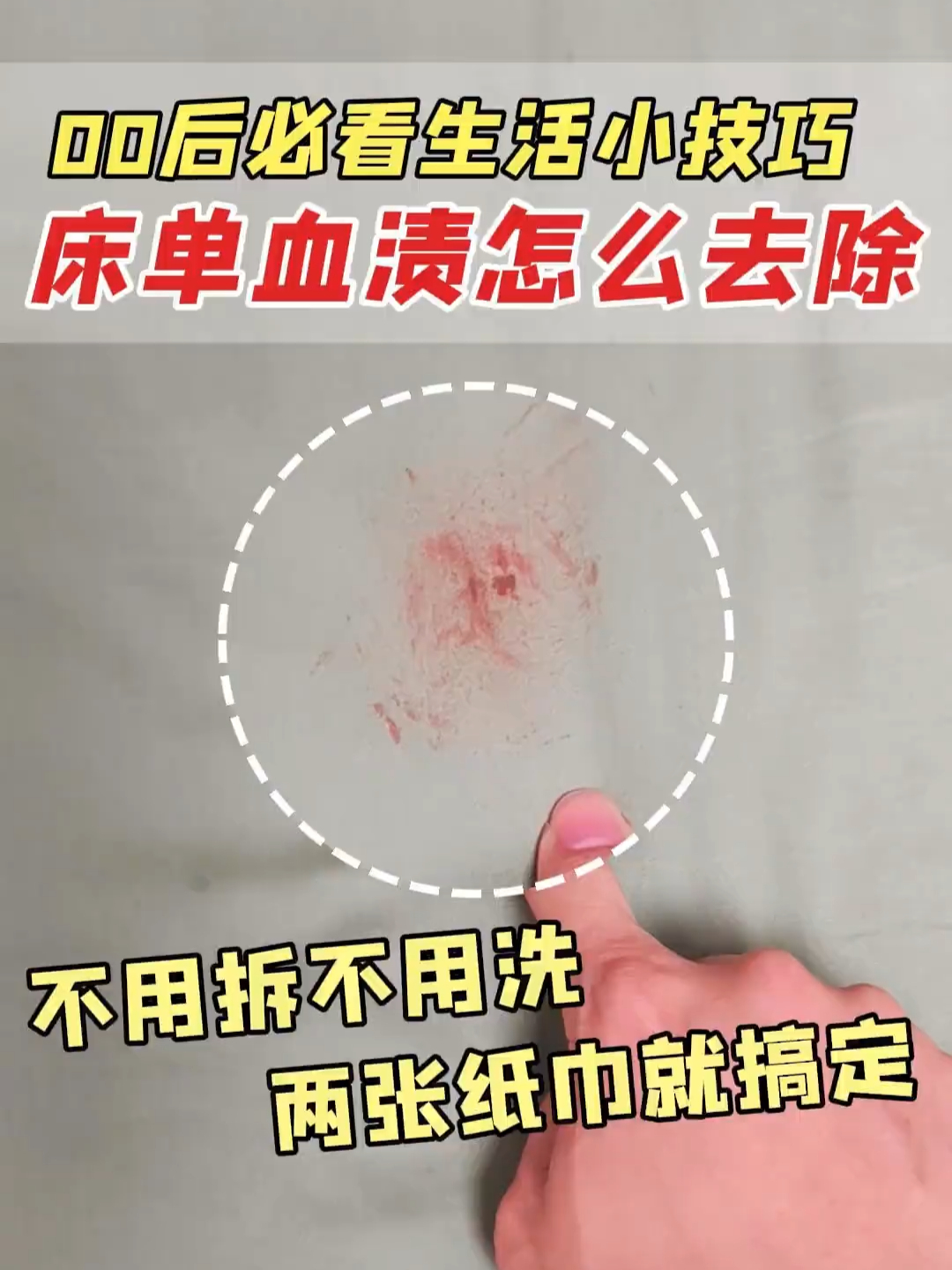 所有女生都进来学，床单血渍怎么去除？ 床单血渍，裤子血渍怎么洗？_腾讯新闻