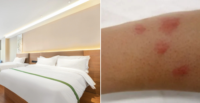 男子在上海住酒店时半夜被咬醒，发现房间爬满床虱，还被反呛“40多岁不会自己去房间看看吗”，酒店：已跟进协商好，并给客人退款缩略图