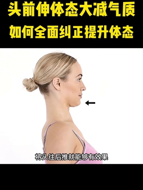 运动体态塑形：头前伸别瞎练！缩脖子推头无效的认知误区与科学改善方法_腾讯新闻