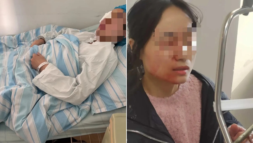 被学生戳伤眼球，女教师发声：希望对涉事女生给予相应处分