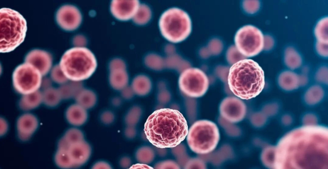 没有便血，39岁确诊直肠癌缩略图