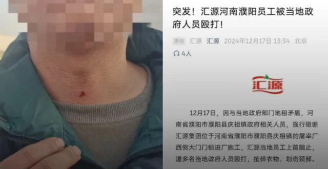 汇源集团发文称员工遭镇政府人员殴打 警方：一名经理被打 正在处理 _腾讯新闻