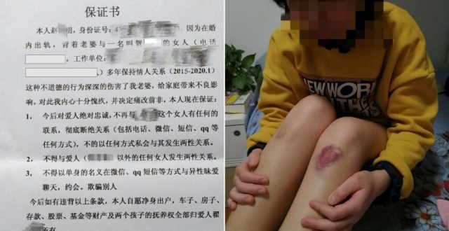 女子死前曾遭丈夫家暴，警方尸检认定系“自发因素”，家属质疑_腾讯新闻
