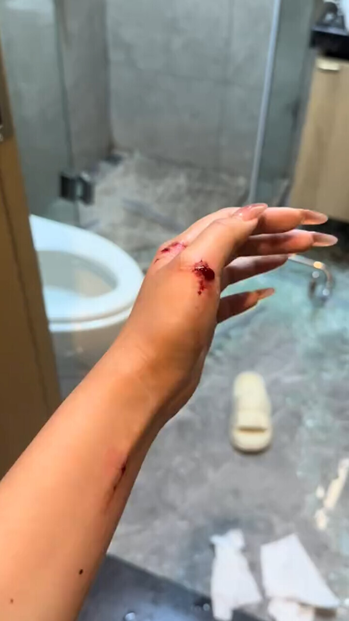 女生洗完澡浴室玻璃突然爆裂,手臂多处被划伤流血:很多人有过同样的