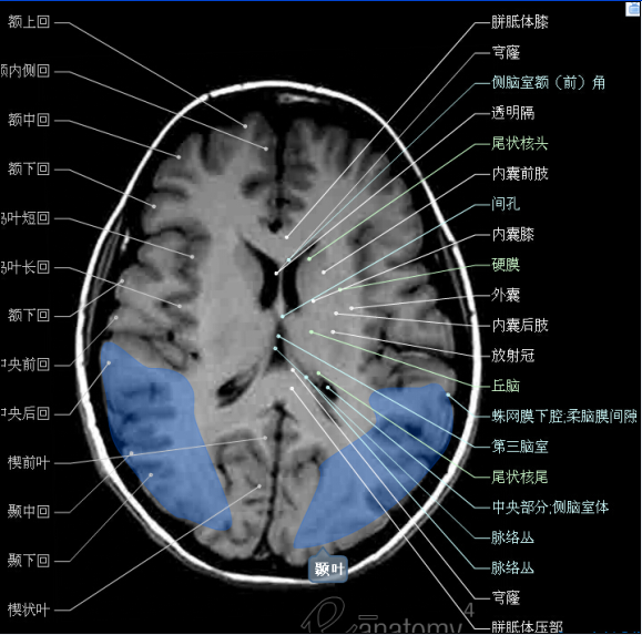 颅脑断层解剖头颅mr轴位解剖图彩色标注版