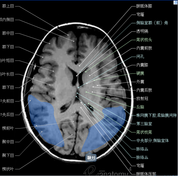 顱腦斷層解剖頭顱mr軸位解剖圖彩色標註版