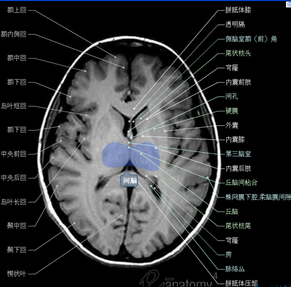 顱腦斷層解剖頭顱mr軸位解剖圖彩色標註版