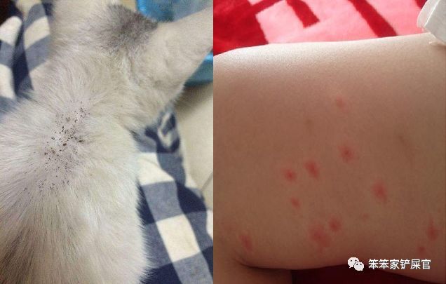 跳蚤吸干了 猫 的血 还想要吸干 人 的血