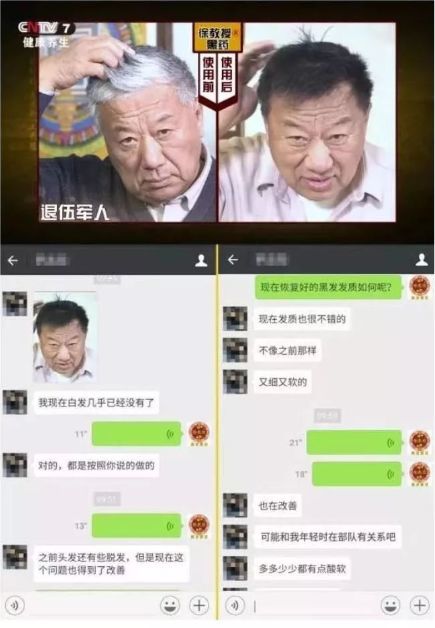 黑发变白发原来是身体缺了它 怪不得白发长那么多 用了就变年轻