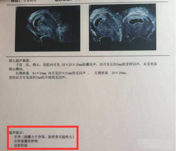 懷孕7周忽然不孕吐了,孕媽擔心胎停,醫生怎麼解釋