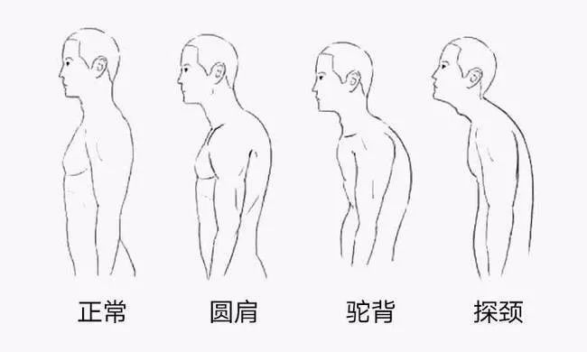 體態決定氣質,含胸駝背氣質差?不如試試這招