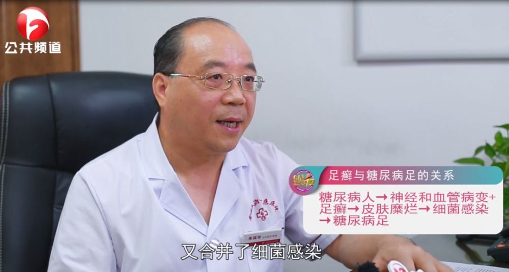 安徽卫视采访我院疮疡科朱保华教授