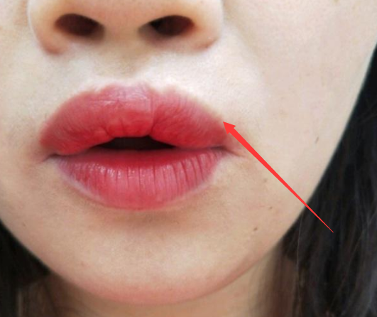 女生公认最丑的3种 唇形 就算中一个 也会 吓退 异性缘
