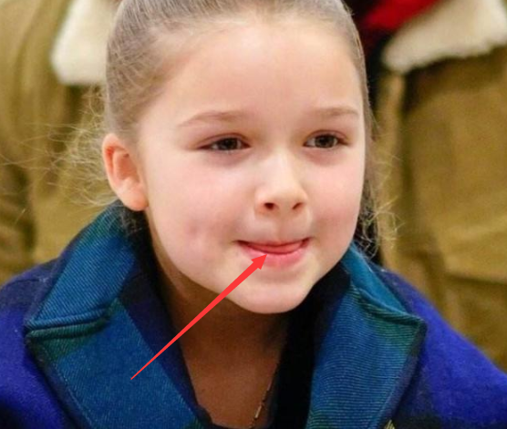 女孩子想变"薄嘴唇"?这3个习惯不能有,当心迟早成"火锅唇"