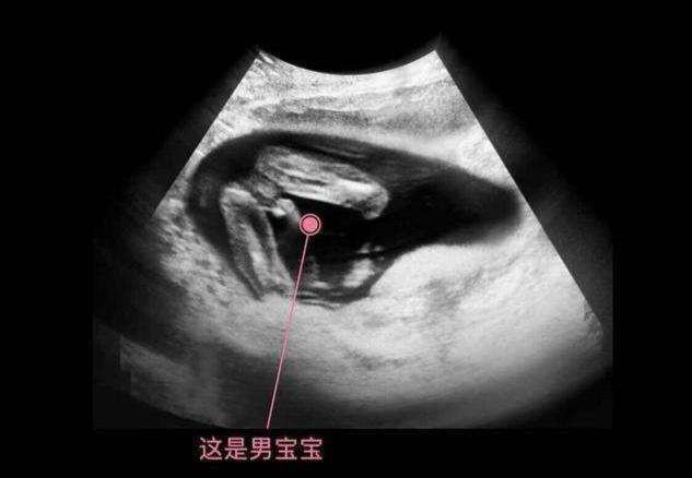 怀孕四个月宝宝在子宫内做些什么胎宝说妈妈你猜猜吧