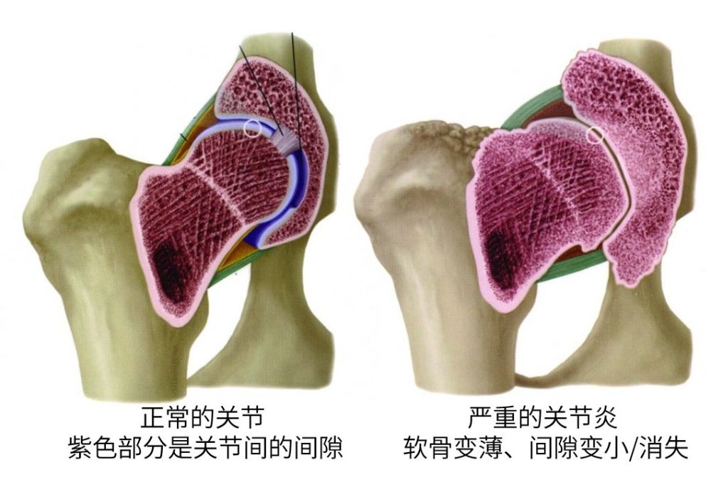 90患病率却只有10确诊2分钟认识猫咪关节炎