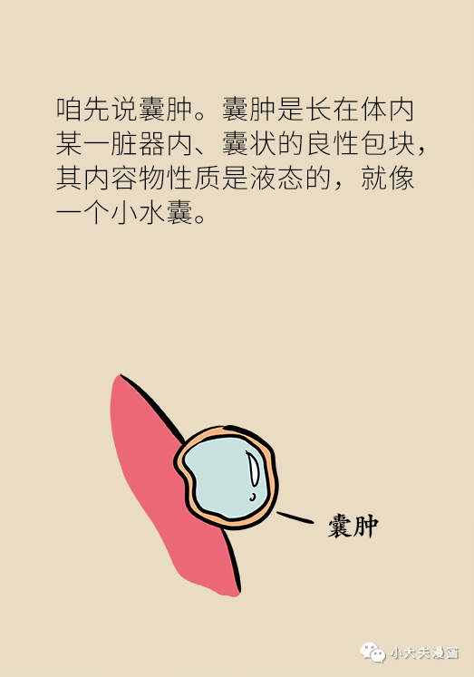 体检查出囊肿,结节,息肉就是癌症先兆?听听专家怎么说!