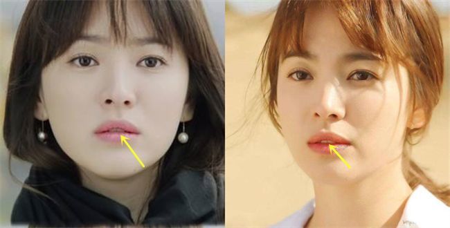 娜扎说话时嘴唇外翻,牙齿对嘴部形态影响