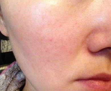 "尖儿货"竟检出甲醛!销量最好的3款洗面奶竟会烂脸!