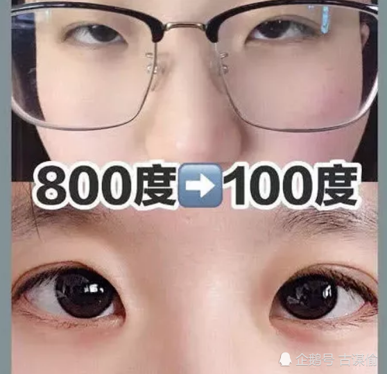 00后近视眼如何"自然恢复"?掌握3招,摆脱"四眼妹"的外号