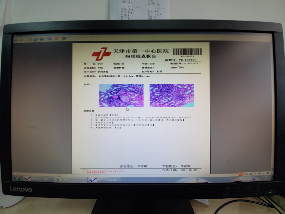 天津市第一中心医院查到的李萍肾脏的病理检查报告.